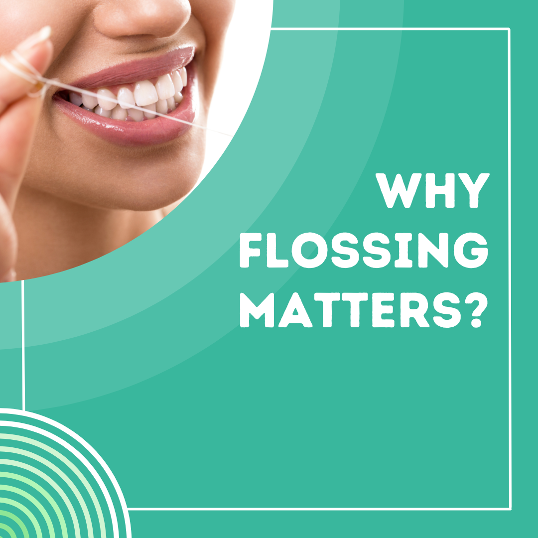 why-flossing-matters-dentist-tysons-corner-va-cosmetic-dentist-in