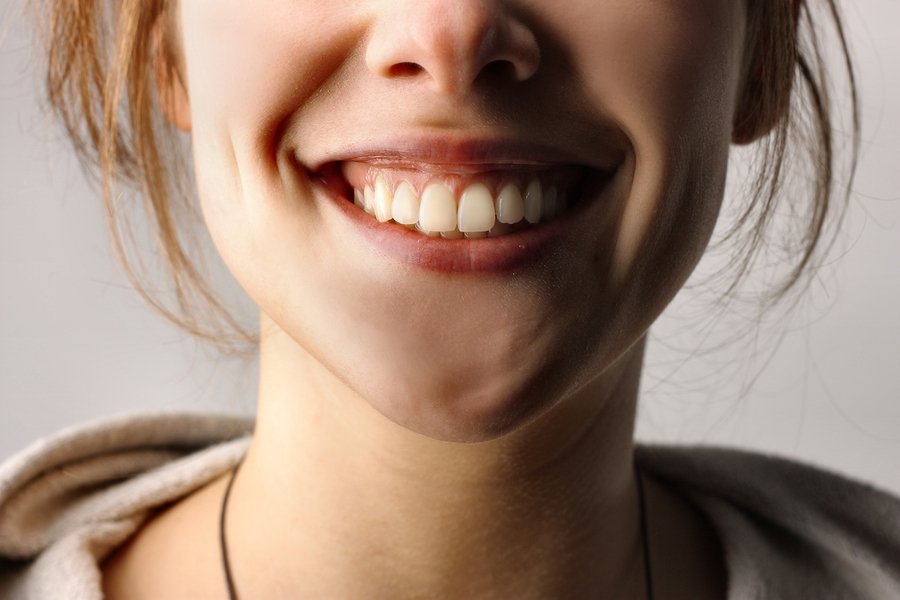 Why are there white spots on my teeth 5 Why Do I have White Spots on My Teeth?