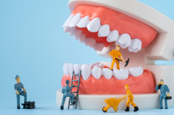 5 Types of Restorative Dental Treatment