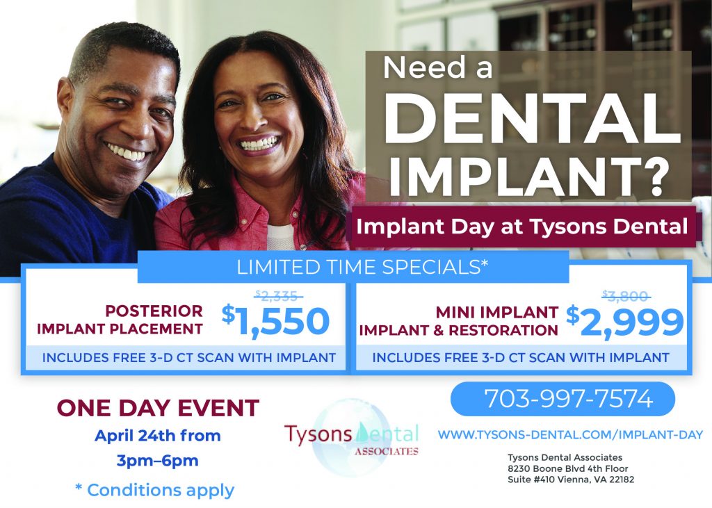 Dental Implants Tysons Corner Va Dental Implant in Tysons